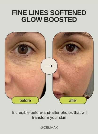Celimax Vita-A Retinal Booster – Firming & Pore Minimizing Korean Skincare