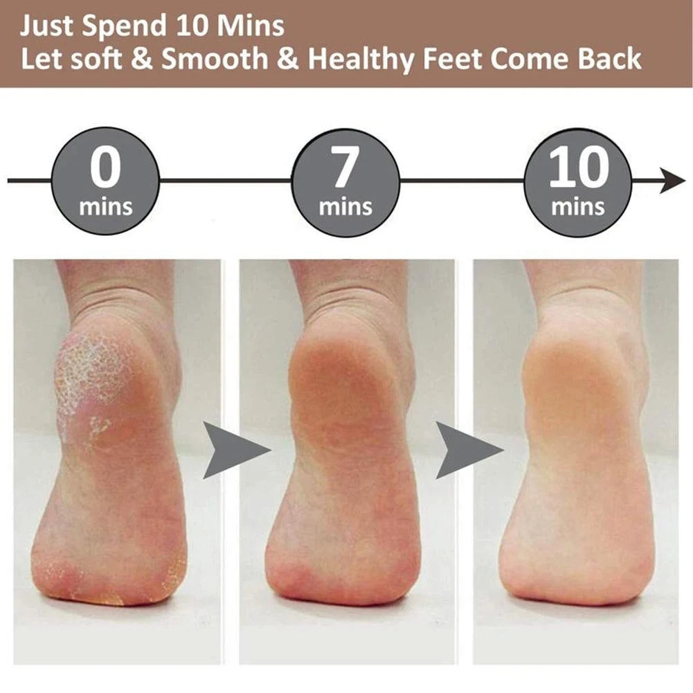 Electric Callus Remover – Rechargeable Foot File & Pedicure Tool for Smooth Feet