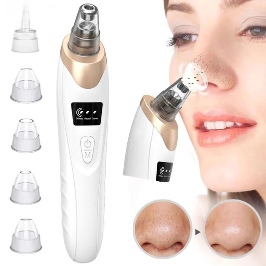 Electric Blackhead Remover – Deep Pore Vacuum Cleaner for Facial Skin Care